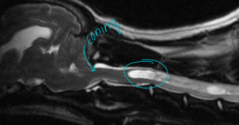 <p>Caudal occipital junction malformations COMS</p>
