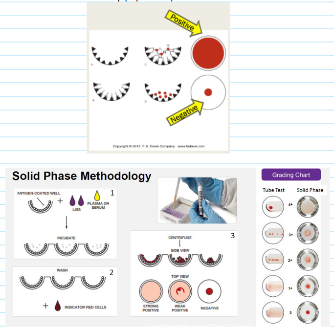 <ul><li><p>Used for antibody screening and antibody identification</p></li><li><p>Relies on antigen-coated wells in solid phase microplates</p></li><li><p>Can be manually performed or on an automated analyzer (Immucor Neo, Immucor Echo)</p></li><li><p>Testing Process:</p><ul><li><p>Screening cells bound to surface of polystyrene microplates</p></li><li><p>Pt plasma and LISS added to the wells</p></li><li><p>RBC antigens capture IgG ABYs during incubation step</p></li><li><p>Microplates washed to remove unbound ABYs</p></li><li><p>Indicator cells (or anti-IgG coated red cells) added to wells</p></li><li><p>Microplates centrifuged to bring indicator cells in contact with bound antibody (if present)</p></li></ul></li></ul><p></p>