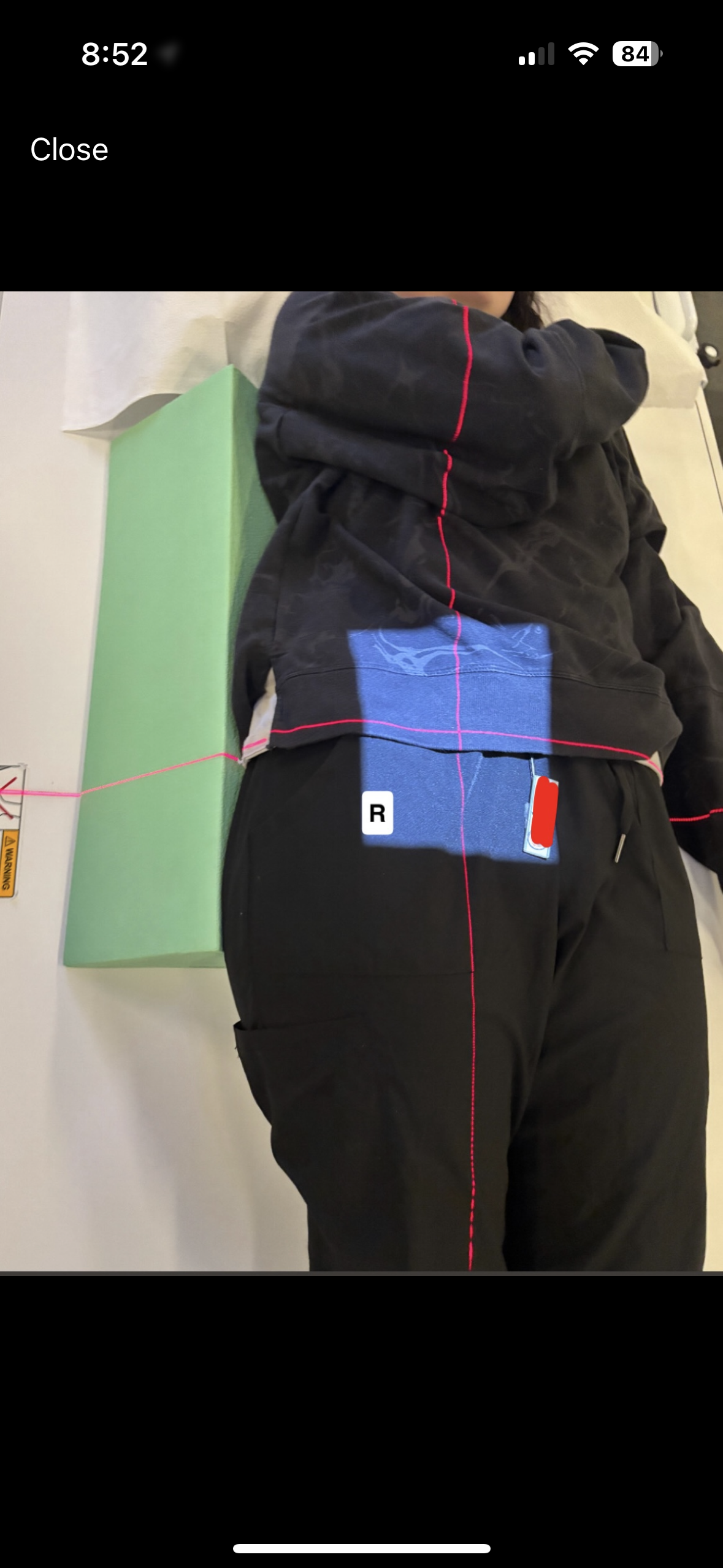 <p>SI joints- R&amp;L Oblique</p>