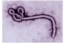 <p>Genus-Filovirus</p>