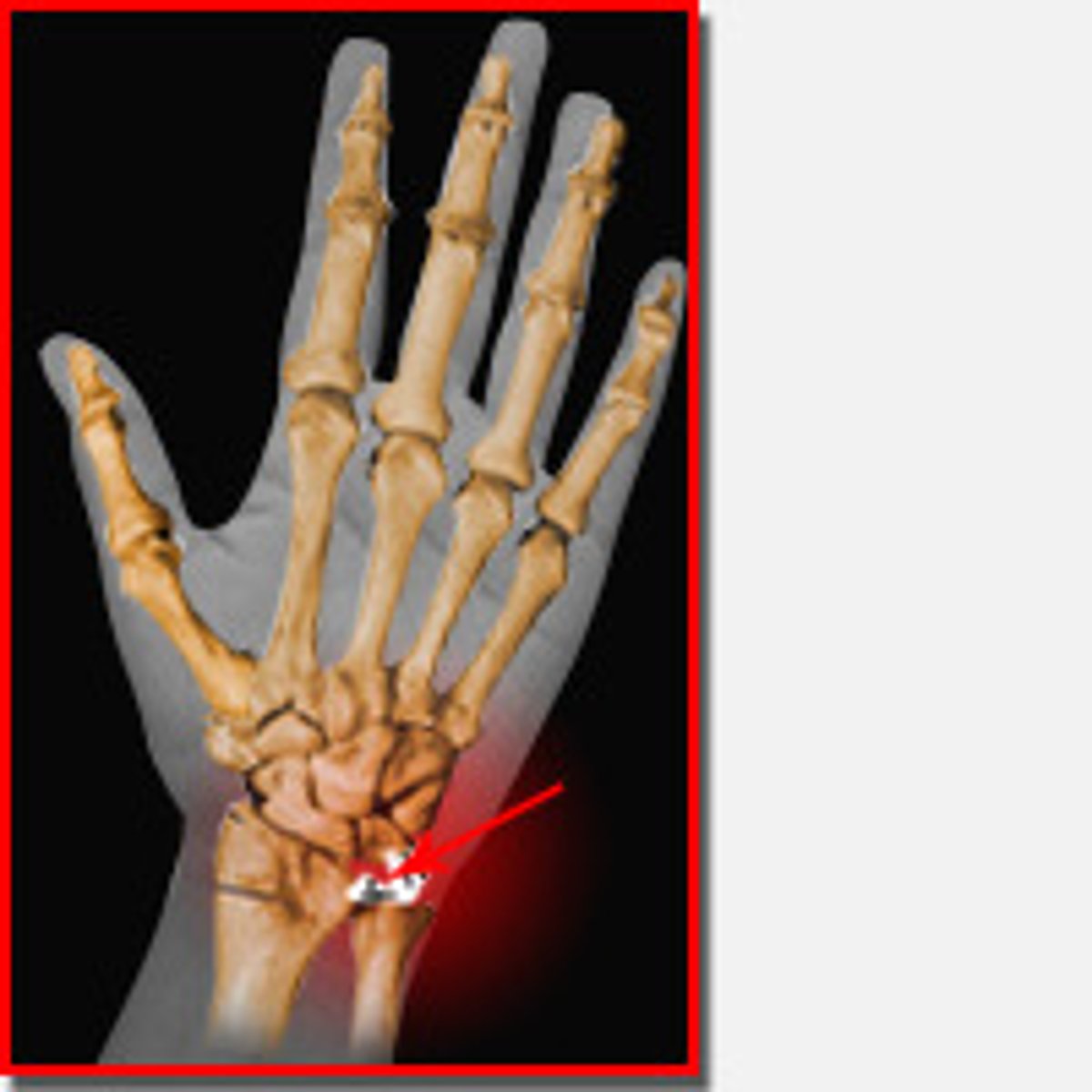<p>if injured can't put weight down on it</p>