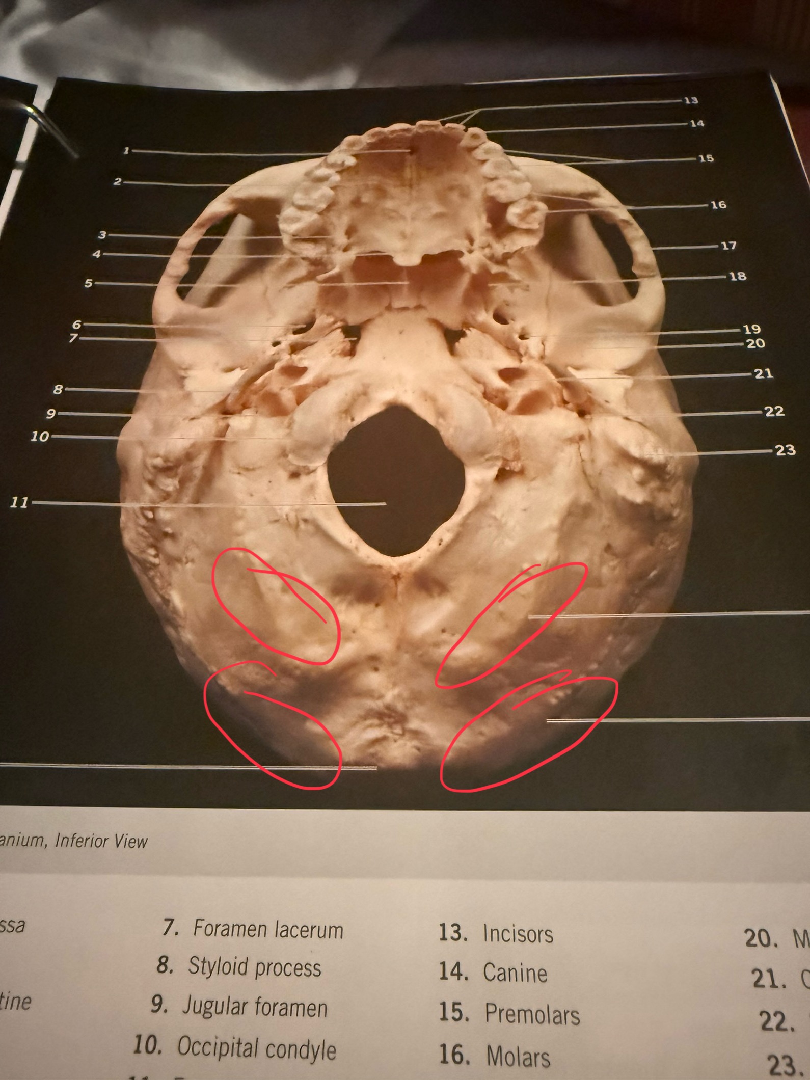 term image