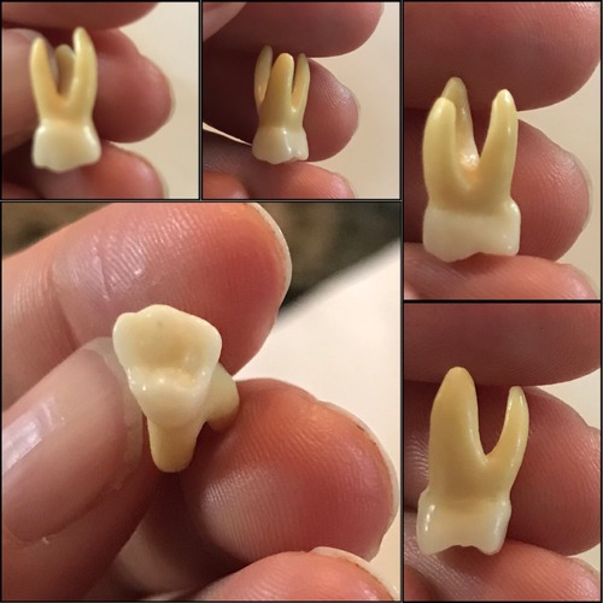 <p>What tooth is this ?</p>