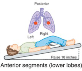 <p>What CPT position is pictured, and when is it used?</p>