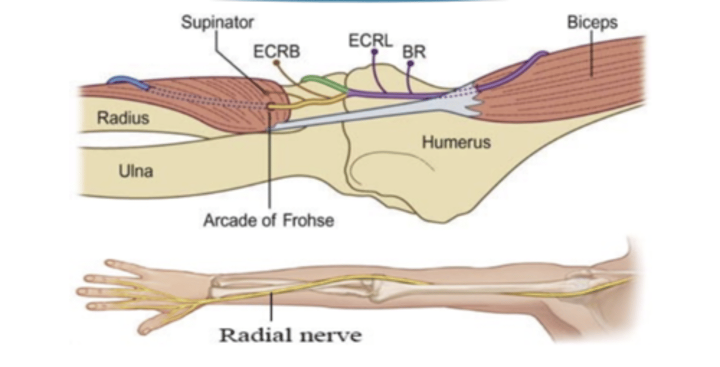 <p>Triceps, Anconeus, Brachioradialis, Supinator, ECRL, ECRB, ECU, ED, EDM, EPL, EPB, EI, APL</p>