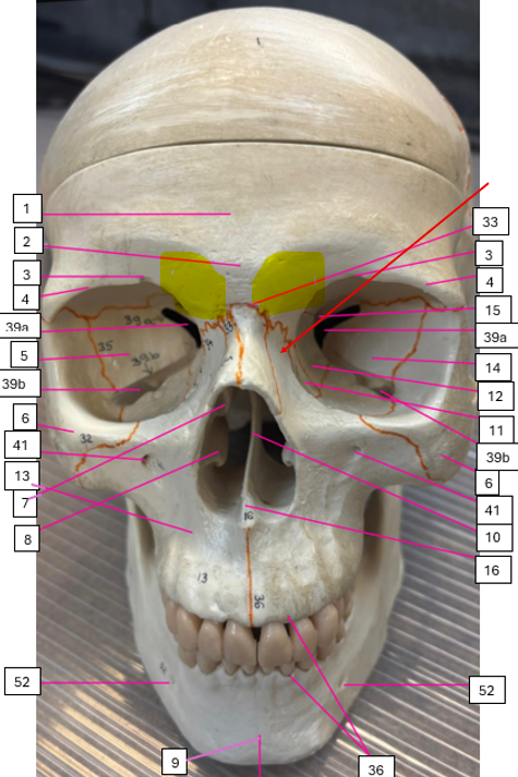 <p>What is highlighted in yellow?</p>
