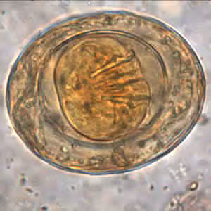 <p>What type of egg is this?</p>