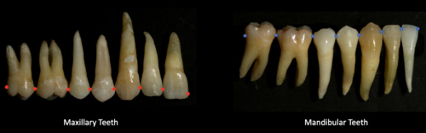 <p>The mesial and distal HOC are normally located at the...</p>