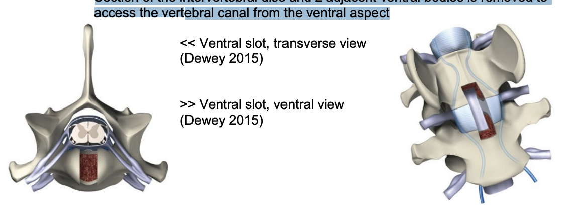 <p>t commonly a ventral slot procedure is performed <span data-name="black_small_square" data-type="emoji">▪</span> Section of the intervertebral disc and 2 adjacent ventral bodies is removed to access the vertebral canal from the ventral aspect</p>