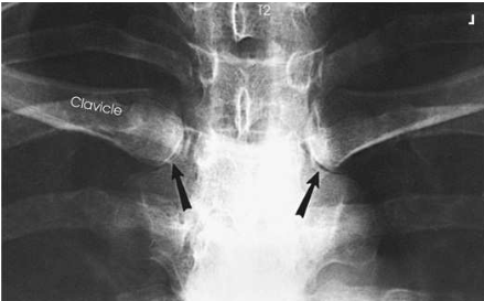 <p>What projection, position and anatomy is this?</p>