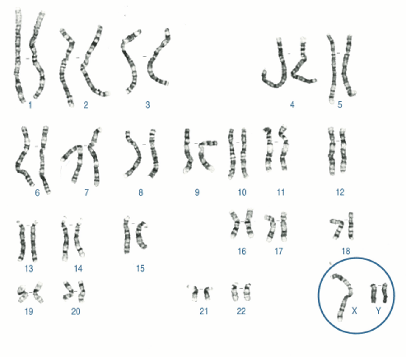 <p>Name:</p><p>- Correctly written karyotype</p><p>- Common name</p><p>- Scientific name</p><p>- One distinguishing clinical feature</p><p>- Definition of this feature if not obvious</p>