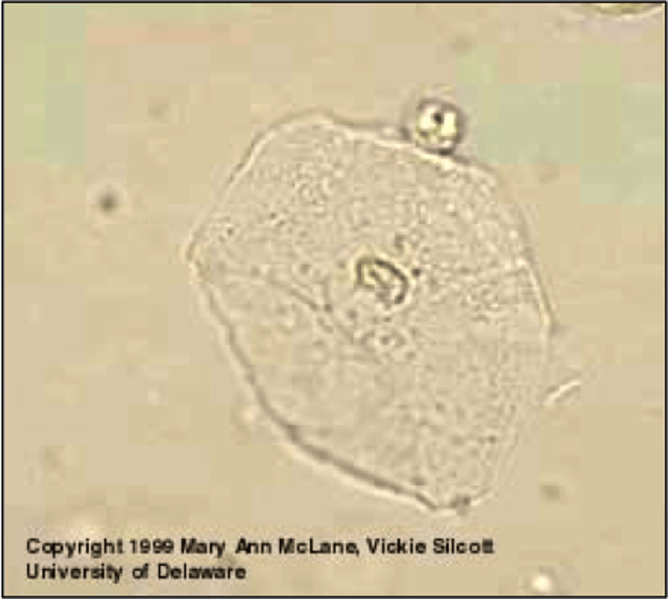 <p>What type of cell is this (urine)?</p>