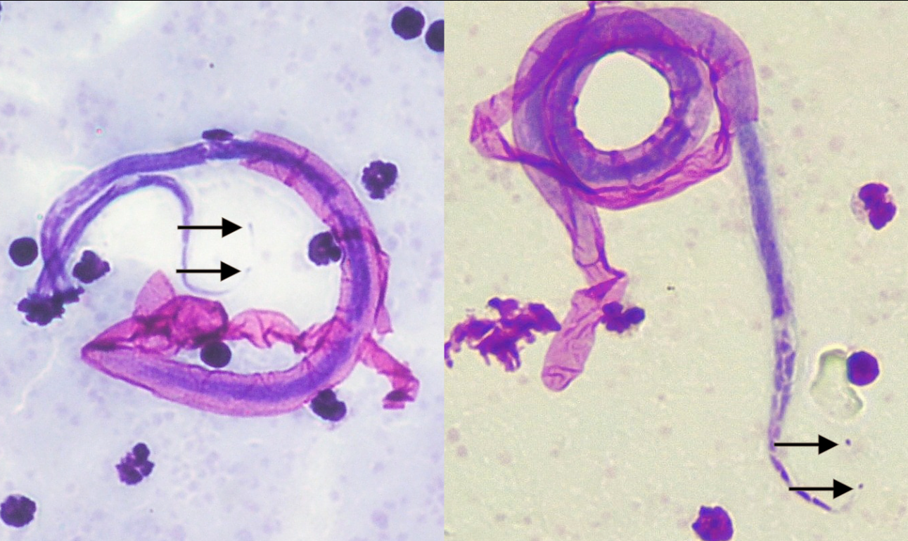 <p>Brugia malayi</p><p>GD</p><p>vector/IS</p><p>dx / disease</p>