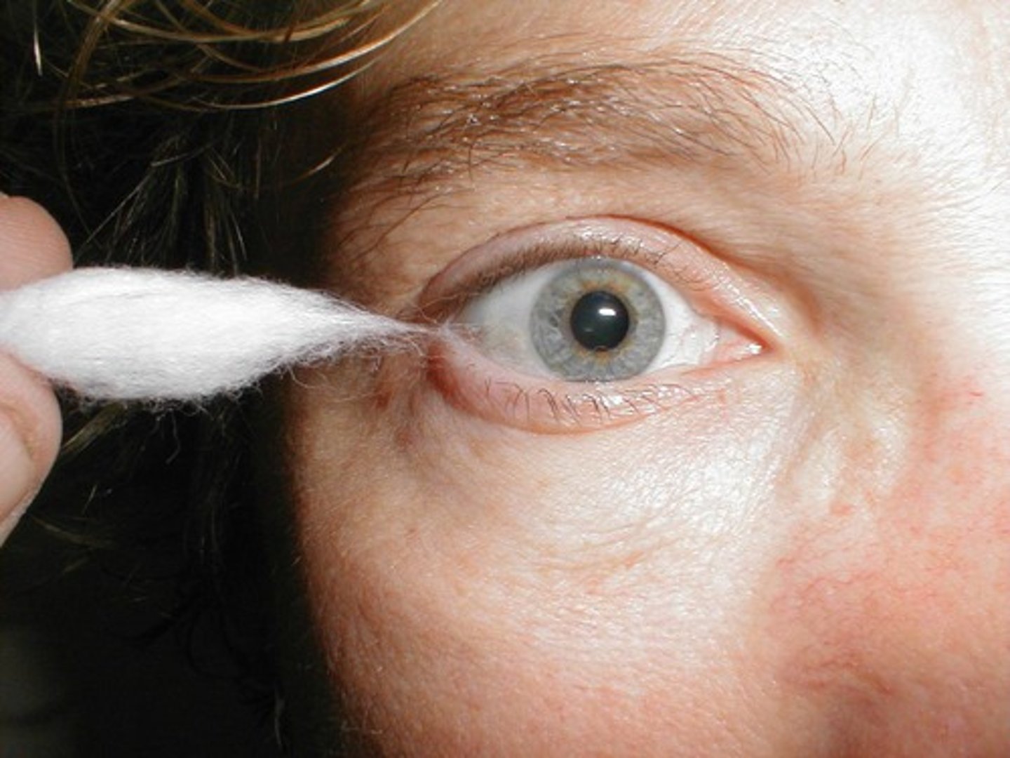 <p>A function of cranial nerve V (trigeminal); touching of the cornea causes blinking to occur.</p>