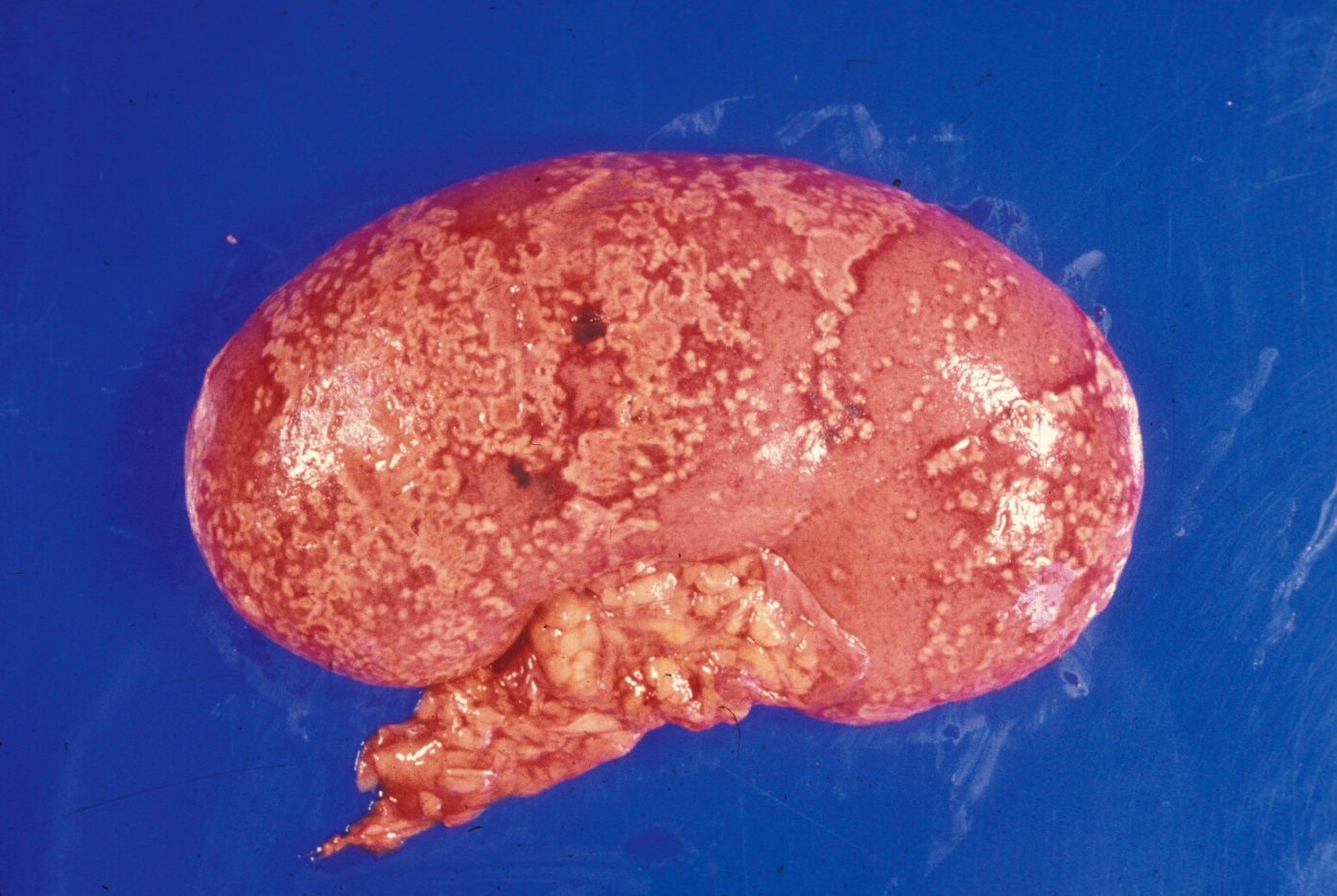 term image