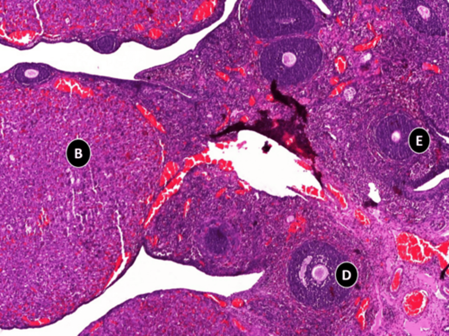 <p>organ</p>