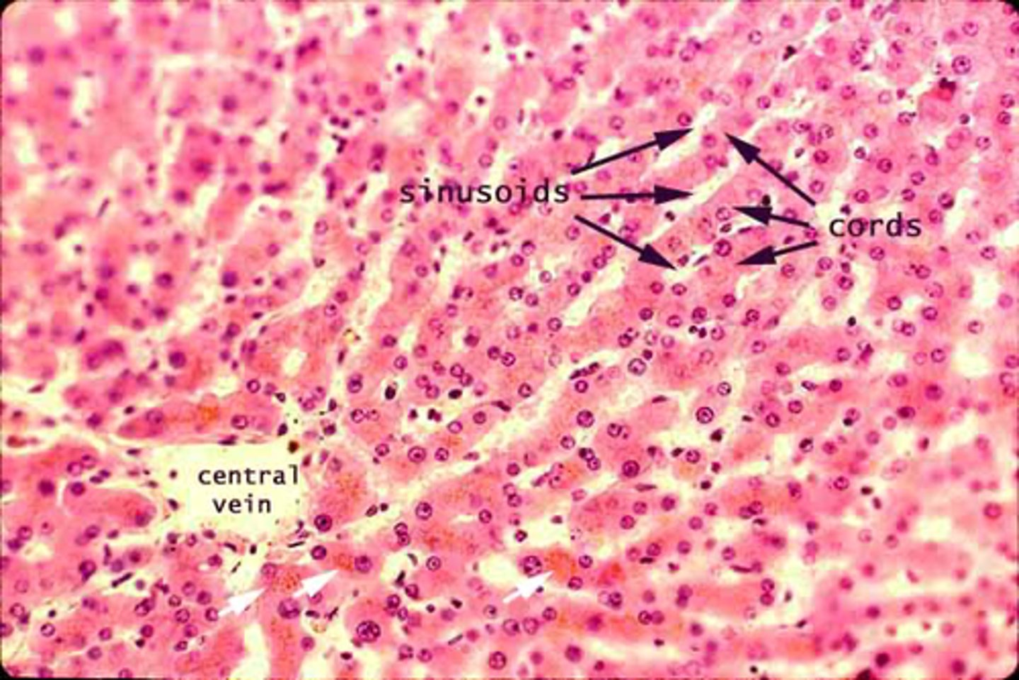 <p>specialized capillaries lined with fenestrated endothelial cells</p><p>the endothelial fenestrations the liver capillaries allow the transfer of small molecules and hence the function of filtration for hepatocytes</p>
