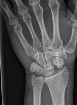 <p>Describe the abnormality demonstrated.</p>