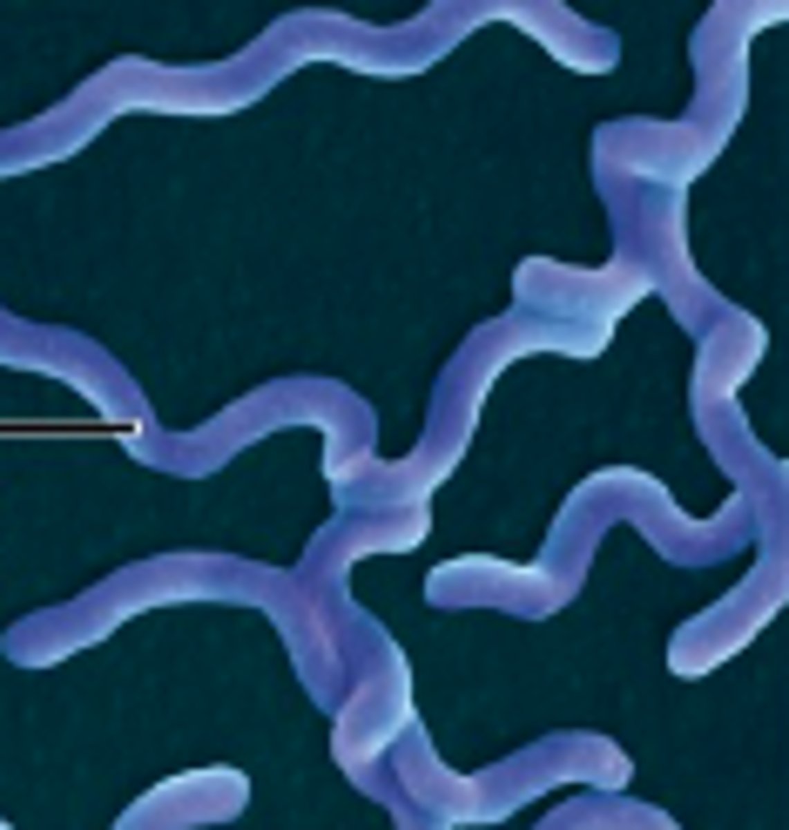 <p>spiral shaped bacteria</p>