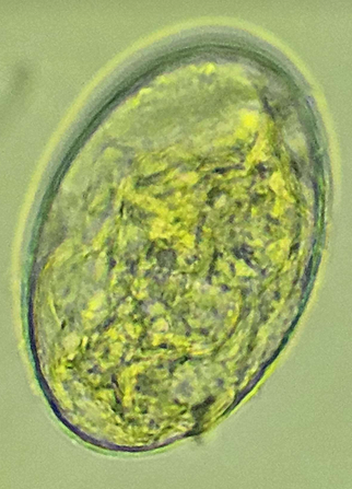 <p><span data-name="microscope" data-type="emoji">🔬</span><span data-name="petri_dish" data-type="emoji">🧫</span><strong><span> </span>Na podstawie zdjęcia preparatu:</strong></p><p></p><ul><li><p><span data-name="book" data-type="emoji">📖</span><span> </span>rozpoznaj gatunek pasożyta;</p></li></ul><p></p><ul><li><p><span data-name="recycle" data-type="emoji">♻</span><span> </span>rozpoznaj wszystkie formy rozwojowe;</p></li></ul><p></p><ul><li><p><span data-name="microbe" data-type="emoji">🦠</span><span> </span>wskaż organelle i cechy charakterystyczne dla danego gatunku;</p></li></ul><p></p><ul><li><p><span data-name="mask" data-type="emoji">😷</span><span> </span>nazwij chorobę, którą pasożyt wywołuje.</p></li></ul><p></p>