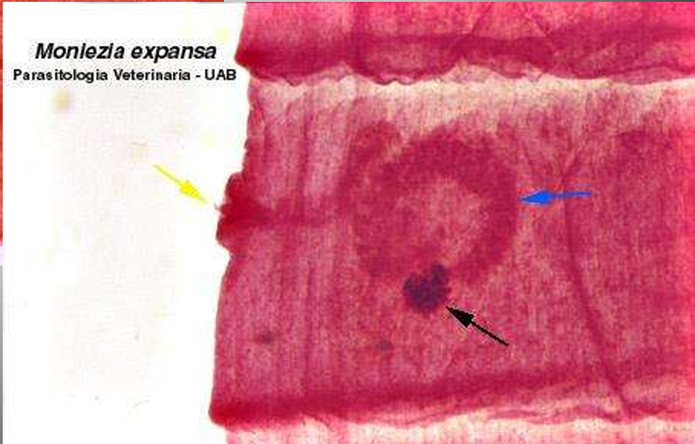 <p>Moniezia expansa</p><p>Immature proglottid</p>