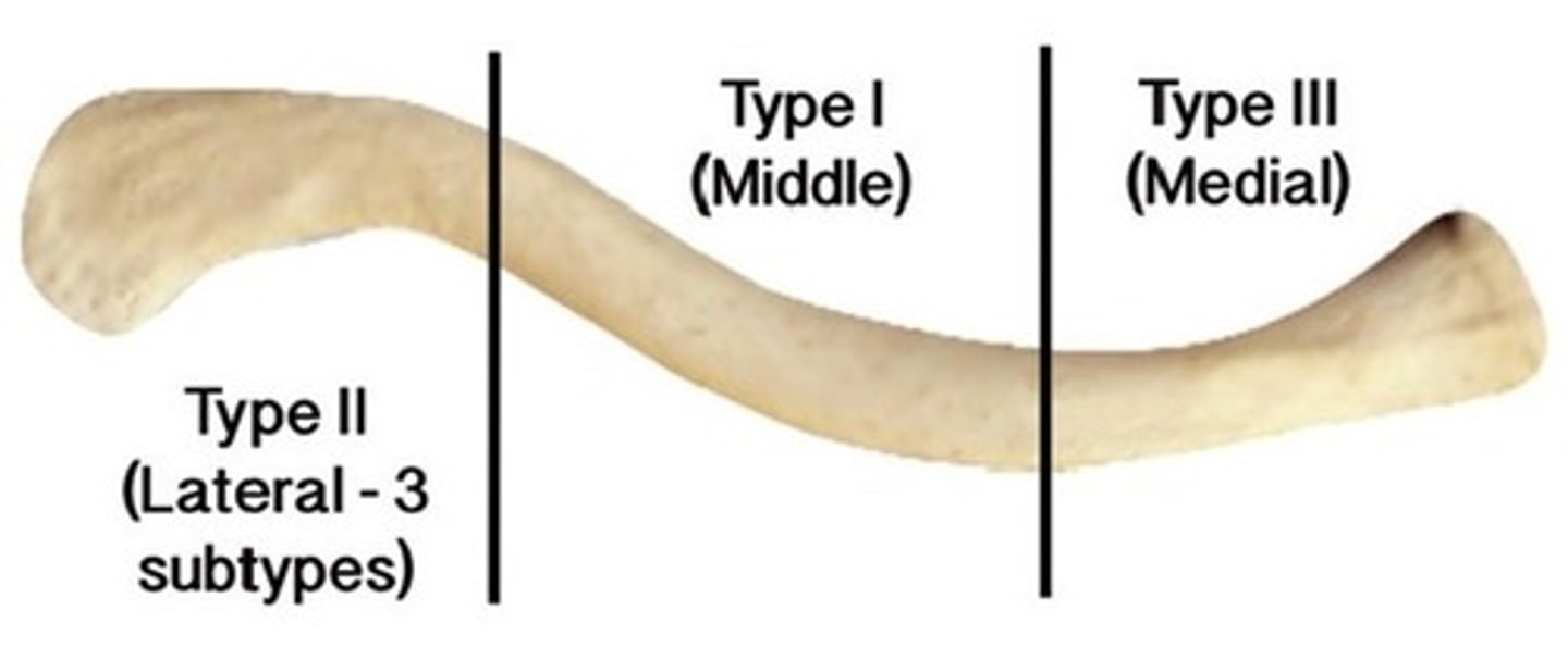 <p>- Caused by FOOSH</p><p>- Classified by: Proximal, medial, distal</p><p>- Surgery needed for open fractures, neurovascular injury, and unstable distal fractures</p><p>- Nonunion: 2 bones don't come together</p>