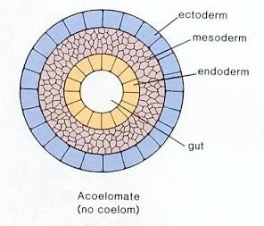 <p>What type of body plan is this?</p>