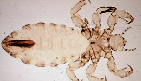 <p>Which parasites are transmitted by <strong>head to head contact</strong> or via <strong>fomites</strong> (debatable) causing <strong>pediculosis capitis?</strong></p><ul><li><p><strong>scalp</strong> <strong>pruritus</strong> occurs as an allergic reaction to <strong>head</strong> <strong>lice</strong> <strong>saliva</strong> injected during feeding</p></li><li><p>lice do not jump, fly, or use pets as vectors</p></li></ul>