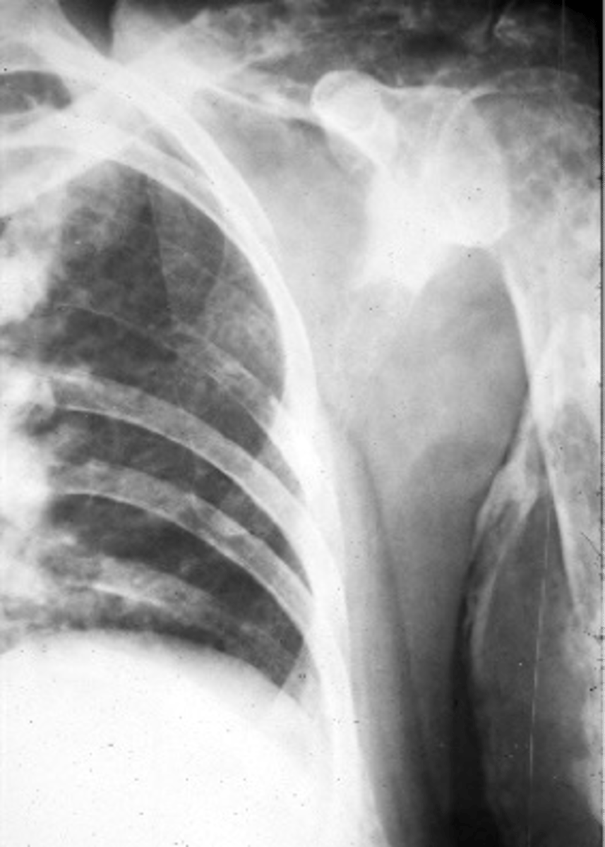 <p>ID imaging technique</p>