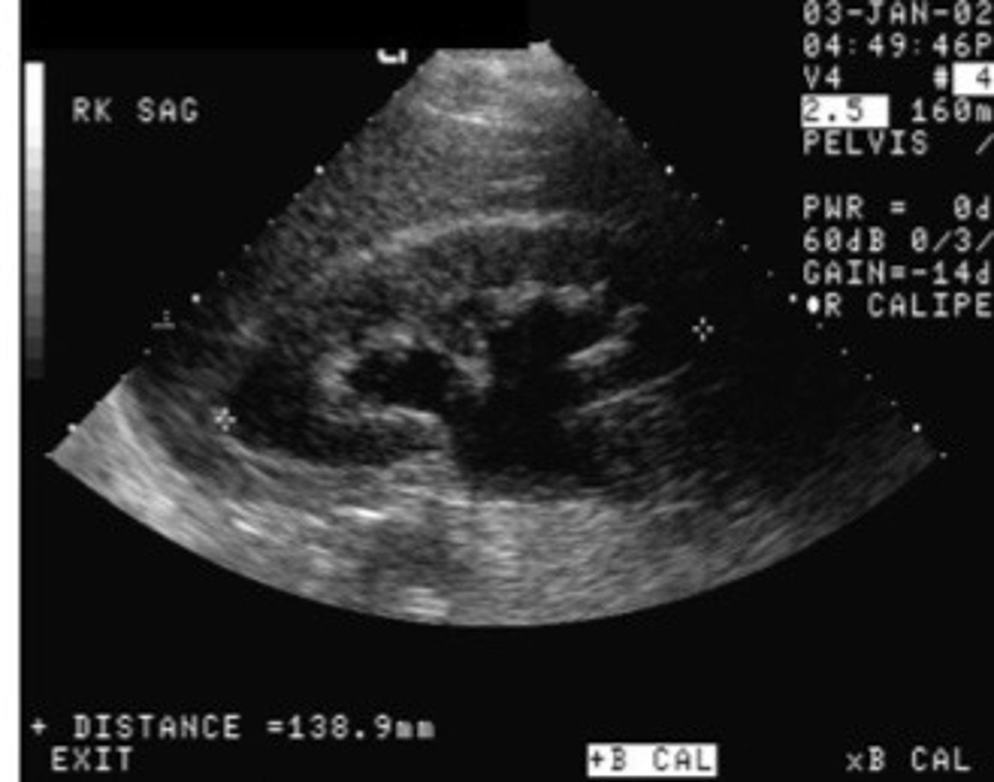 <p>What does this image show</p>