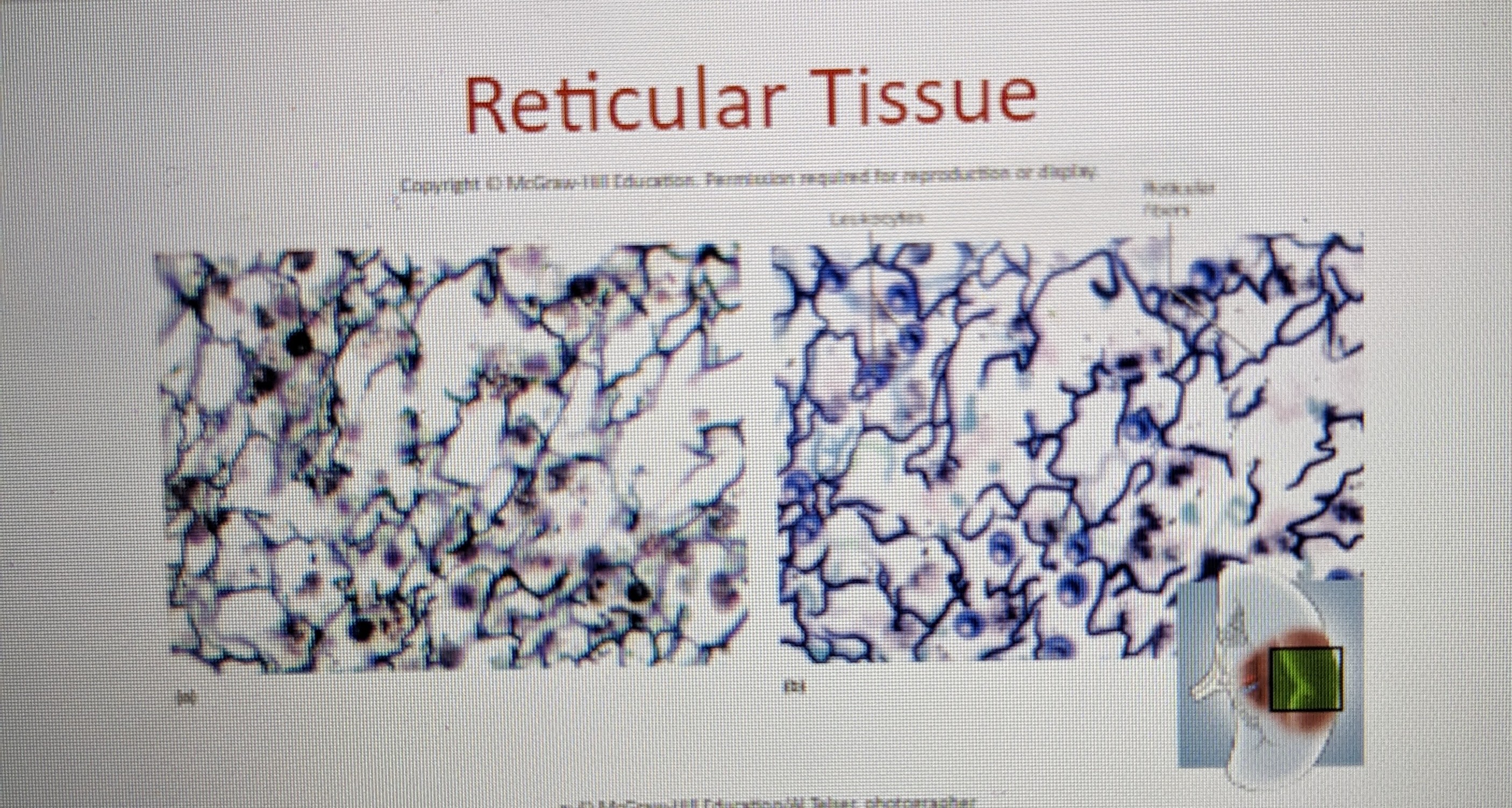 * mesh of reticular fibers and fibroblasts 
* forms supportive stroma (framework) for **lymphatic** organs 
* found in lymph nodes, spleen, thymus, bone marrow 
* filter stuff