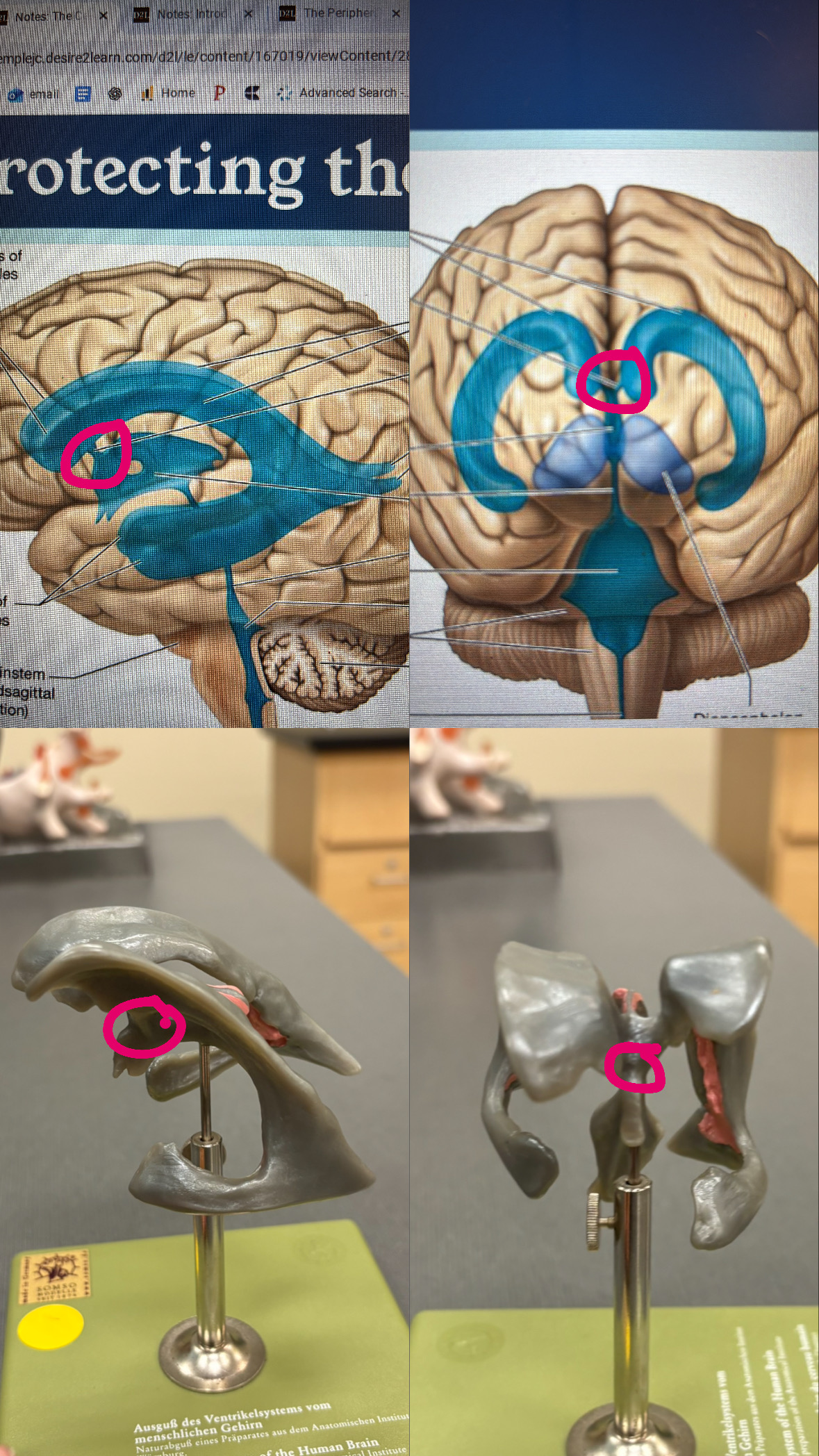 <p>connects the lateral venteicles to the third ventricle </p>