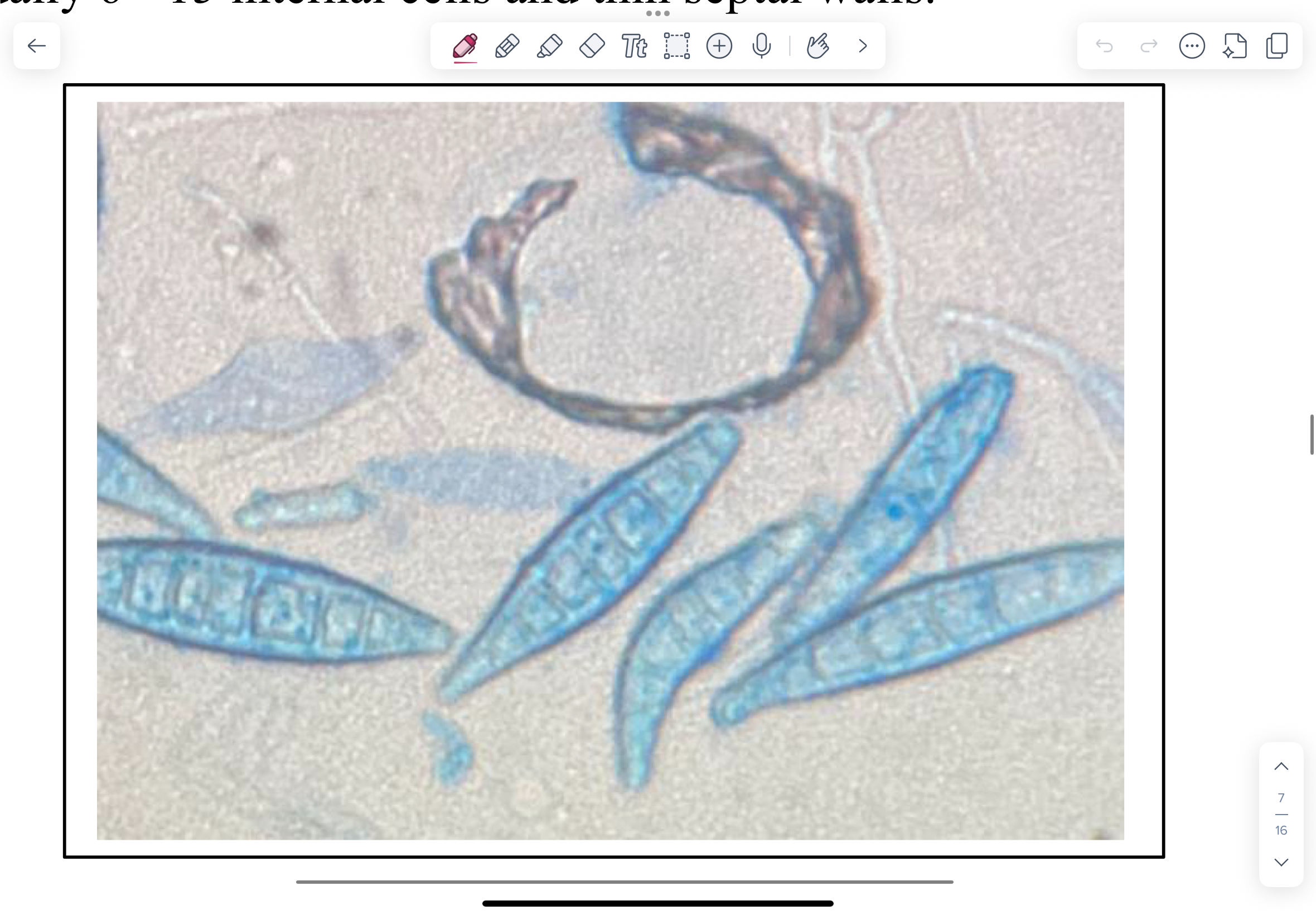 <p>M. canis macroconidia are spindle-shaped, long, rough, with a terminal knob, and thick outer cell</p><p>walls. There are usually 6 - 15 internal cells and thin septal walls.</p>