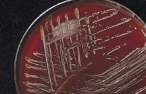 <ul><li><p><strong>A. aphrophilus (formerly known as H. aphrophilus)</strong></p><p>• Coccobacillary</p><p>• Round, convex colonies</p><p><strong>• Requires CO2</strong></p><p><strong>• Requires heme (factor X) for initial isolation (grows on BAP)</strong></p><p>• Can be weakly ALA positive</p><p>• Nonhemolytic on horse blood agar</p><p>• Weak oxidase positive</p><p>• Catalase, indole and urease negative</p><p>• Glucose and lactose positive</p><p></p></li></ul><p></p>