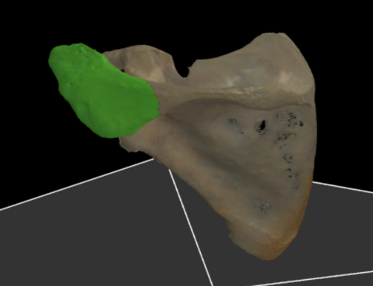 <p><span>laterale uiteinde van de spina scapulae</span></p>