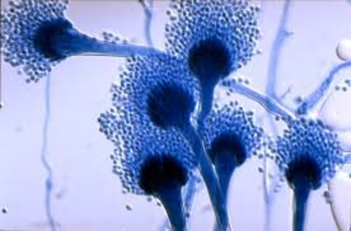 <p>• Blue-green colonies</p><p>o White apron and reverse</p><p>• Single row of phialides</p><p>covering top 2/3 of vesicle</p>
