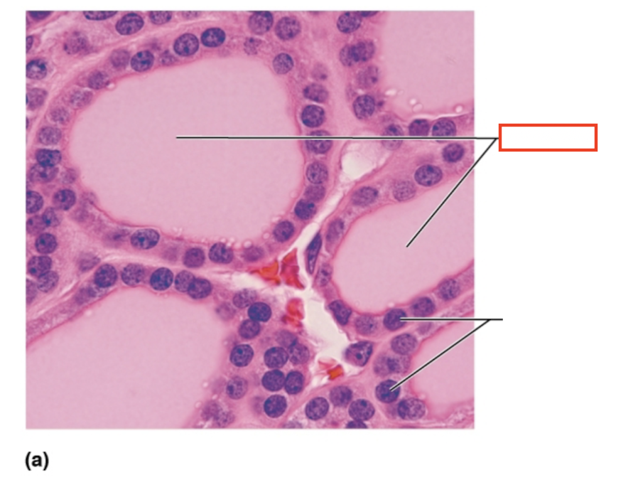 <p>What structure is highlighted?</p>