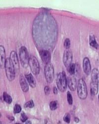 <p><strong>Goblet Cell</strong></p>