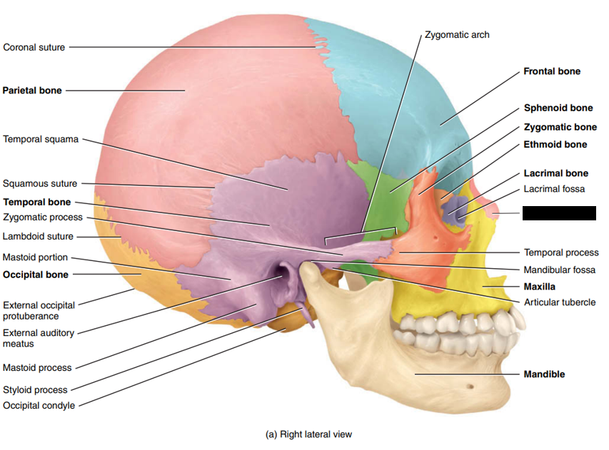 <p>State and identify what part of the cranial bone is being pointed out and censored. (hint: bone)</p>