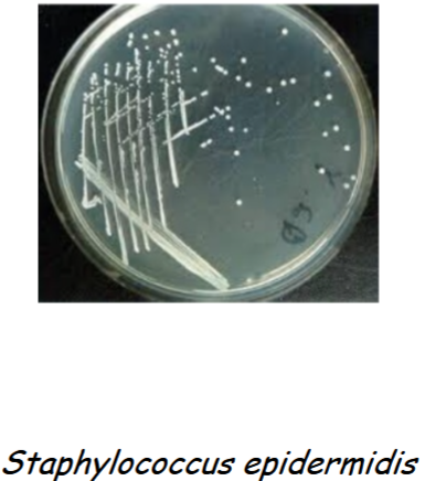 <p>gram positive, colorless or not present and non lactose fermenter (-)</p>