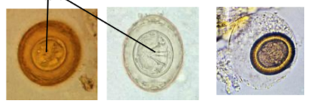 <p>Cyclophyllidea - larva from egg are called? and develops into?</p>
