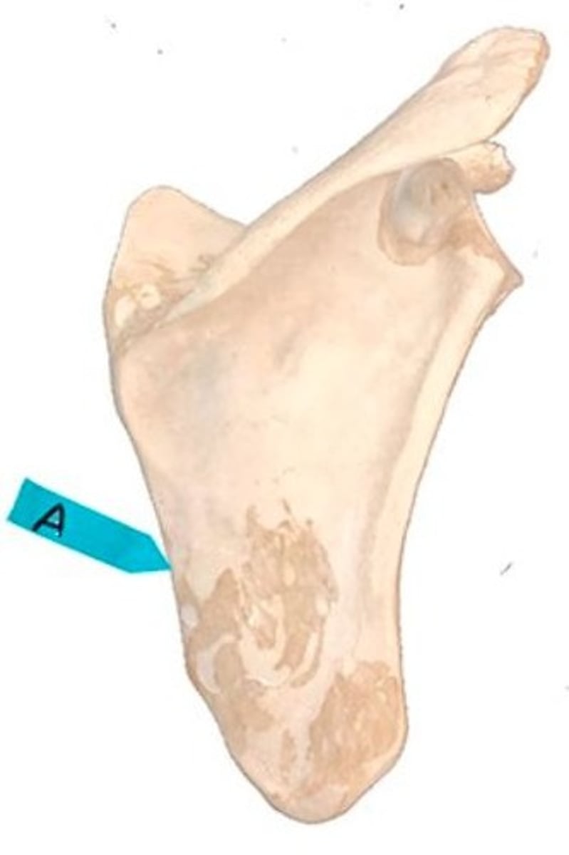 <p>Identify this bone marking.</p>