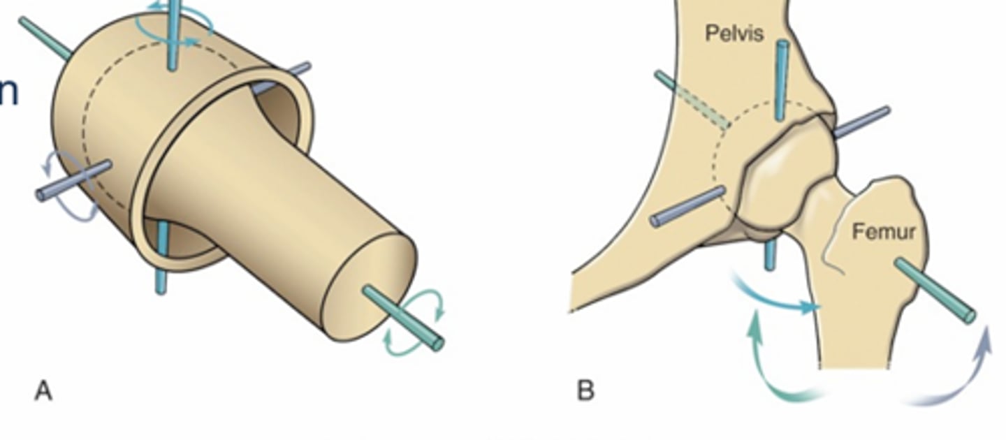 <p>3 DOF, 3 axis of rotation<br>Surfaces allow spin without dislocation<br>Movement in all 3 cardinal planes <br>EX: hip, shoulder</p>