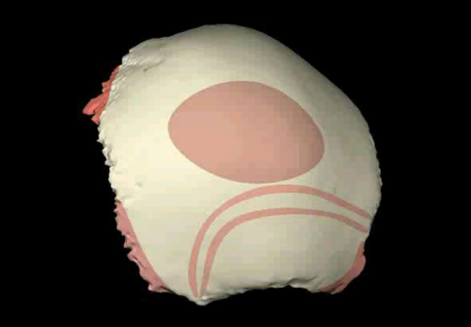 term image