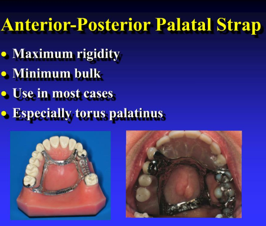 <p>Describe Anteroposteriro palatal strap</p>