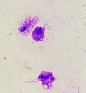 <p><span>trichomonas vaginalis</span></p>