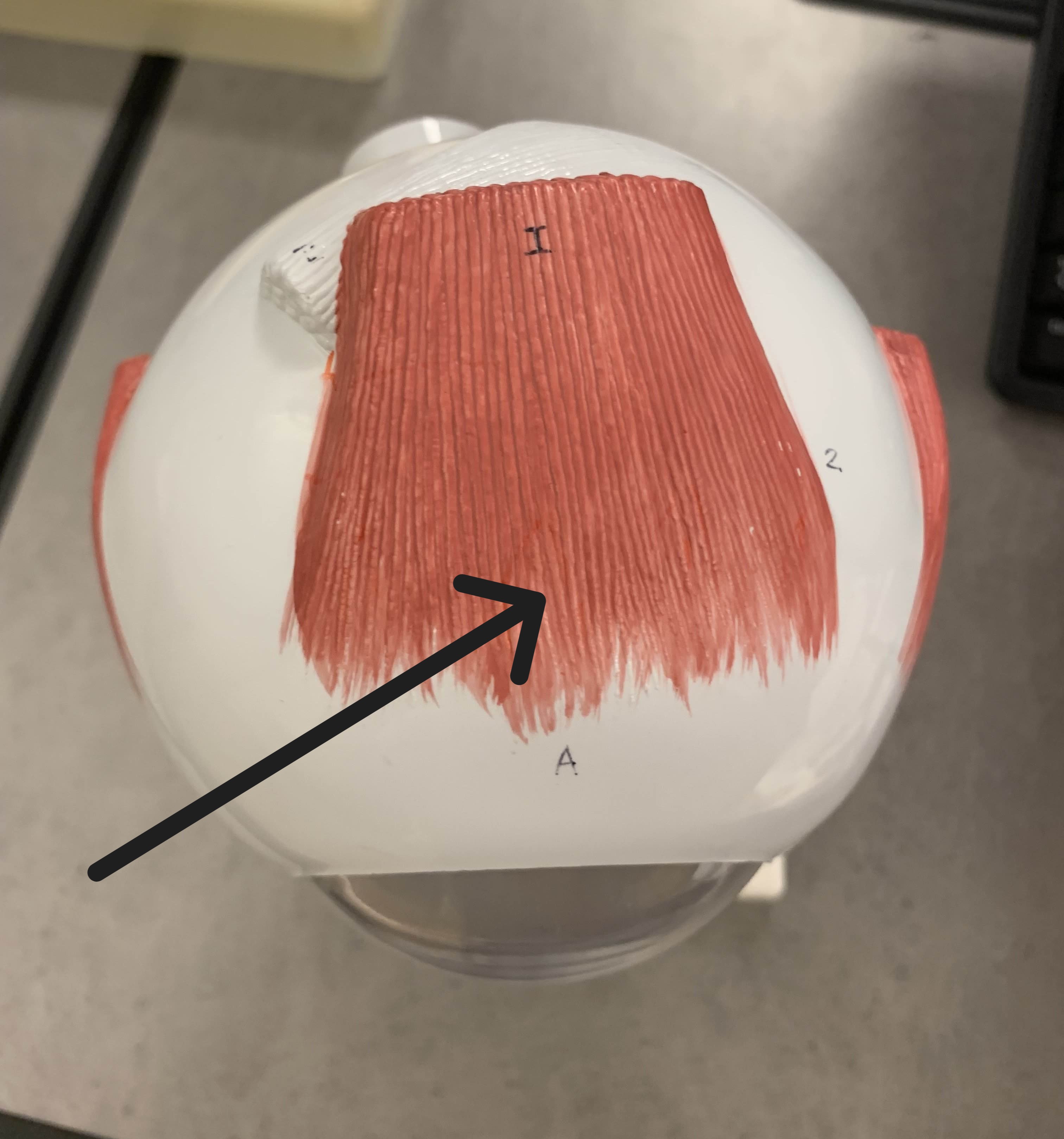 <p>Which muscle of the eye is:</p><ul><li><p>Located superior to the pupil</p></li><li><p>Action: eye looks up</p></li><li><p>Nerve: <span style="color: yellow;">CN III</span></p></li></ul><p></p>