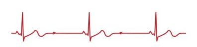 <p>What is<strong> bradycardia</strong>?</p>
