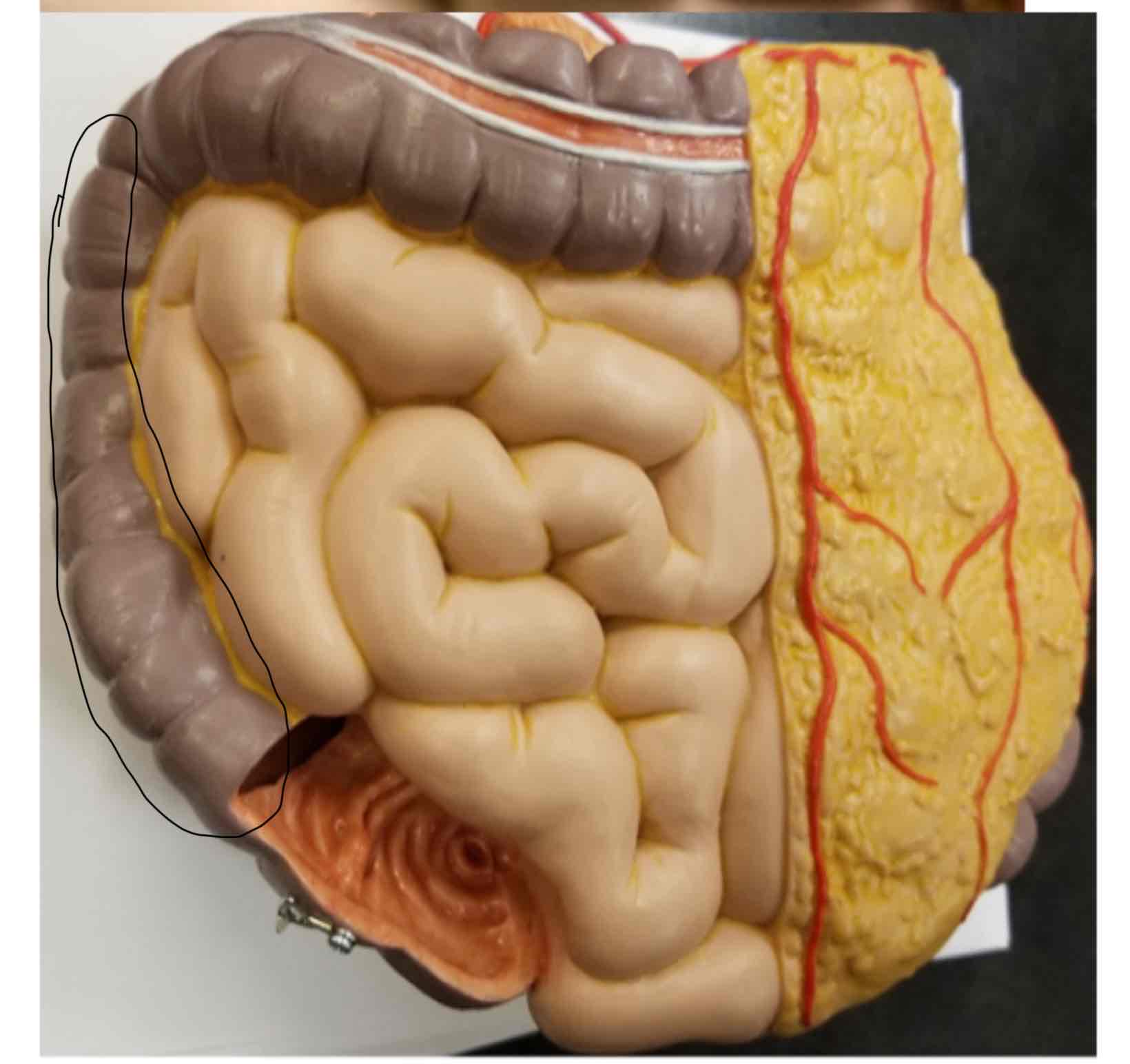 <p>Ascending Colon</p>