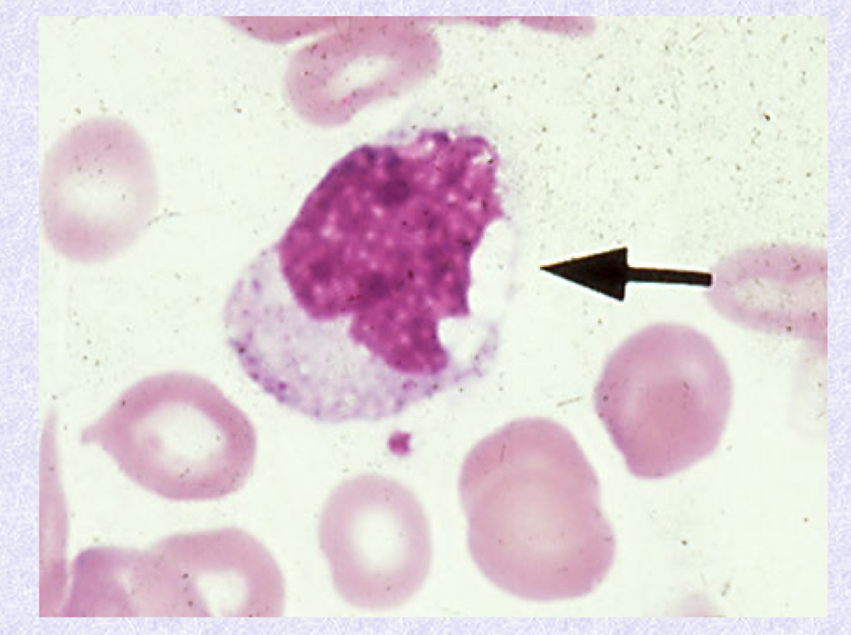<p>What cell type is shown?</p>